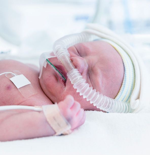 Imagen del curso Patologías respiratorias del recién nacido